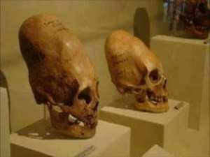 Les crânes allongés découverts depuis plusieurs années,seraient d'origine Annunaki (extraterrestre).